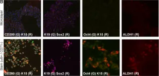 Fig.3.B showing Immunocytochemistry-immunofluorescence in a Homo sapiens (Human) sample from the publication: Identification of a population of epidermal squamous cell carcinoma cells with enhanced potential for tumor formation.