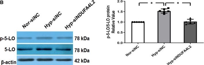 Fig.7.B showing Western Blotting from the publication: NDUFA4L2 in smooth muscle promotes vascular remodeling in hypoxic pulmonary arterial hypertension.