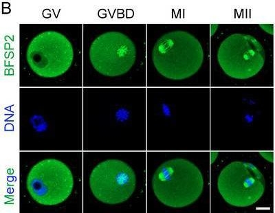 Fig.1.B showing Immunocytochemistry-immunofluorescence from the publication: Intermediate Filament Protein BFSP2 Controls Spindle Formation via HSC70-Mediated Stabilization of CLTC During Oocyte meiosis.