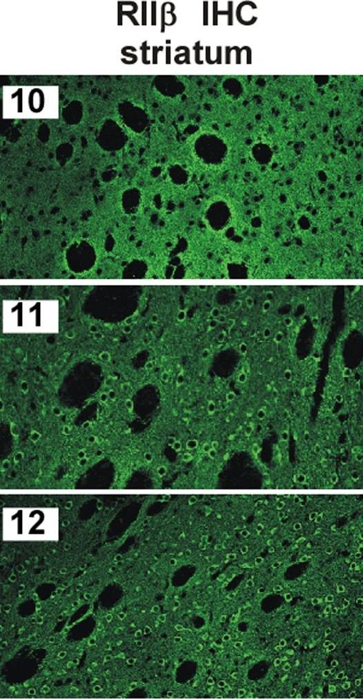 Fig.2.C showing Immunohistochemistry in a Mus musculus (House mouse) sample from the publication: Mutations in AKAP5 disrupt dendritic signaling complexes and lead to electrophysiological and behavioral phenotypes in mice.