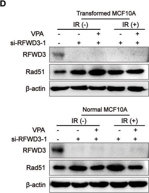 Fig.4.D showing Western Blotting from the publication: The Valproate Mediates Radio-Bidirectional Regulation Through RFWD3-Dependent Ubiquitination on Rad51.