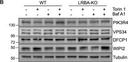 Fig.8.B showing Western Blotting from the publication: LRBA deficiency impairs autophagy and contributes to enhanced antigen presentation and T-cell dysregulation.
