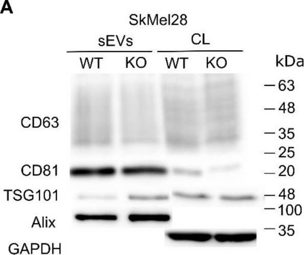 Fig.5.A showing Western Blotting in a Homo sapiens (Human) sample from the publication: Impact of Rab27 on Melanoma Cell Invasion and sEV Secretion.