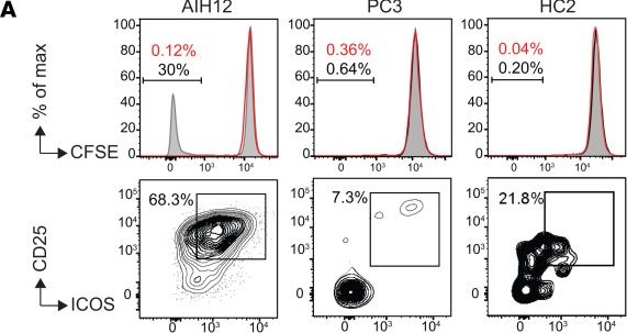 Fig.4.A showing Flow cytometry/Cell sorting in a Homo sapiens (Human) sample from the publication: Clonal analysis of SepSecS-specific B and T cells in autoimmune hepatitis.