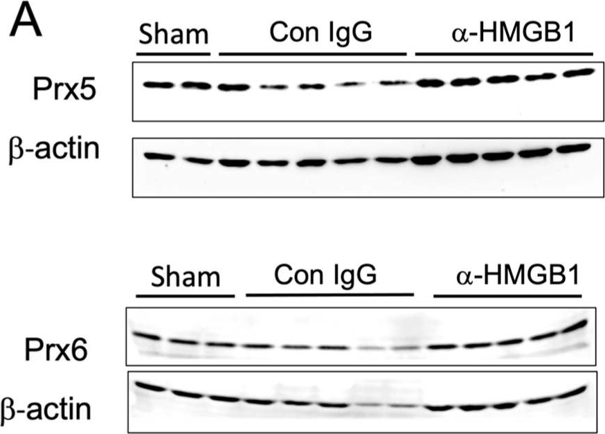 Fig.3.A showing Western Blotting from the publication: Anti-HMGB1 mAb Therapy Reduces Epidural Hematoma Injury.