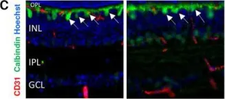 Fig.4.C showing Immunohistochemistry in a Mus musculus (House mouse) sample from the publication: In Utero Alcohol Exposure Impairs Retinal Angiogenesis and the Microvessel-Associated Positioning of Calretinin Interneurons.