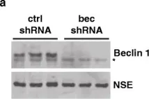 Fig.1.A showing Western Blotting in a Homo sapiens (Human) sample from the publication: Beclin 1 regulates neuronal transforming growth factor-β signaling by mediating recycling of the type I receptor ALK5.
