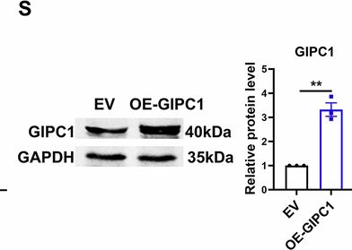 Fig.2.S showing Western Blotting from the publication: GIPC1 governed ferroptosis by regulating DECR1-modulating lipid homeostasis during dilated cardiomyopathy (DCM).