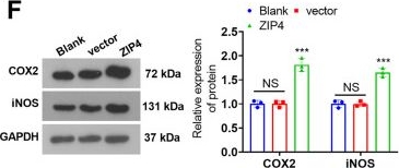 Fig.3.F showing Western Blotting from the publication: ZIP4 upregulation aggravates nucleus pulposus cell degradation by promoting inflammation and oxidative stress by mediating the HDAC4-FoxO3a axis.