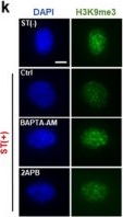 Fig.4.K showing Immunocytochemistry-immunofluorescence from the publication: Temporal Stretch-Induced Nuclear Mechanosensing Coordinates Early Chromatin Accessibility and Genome Protection.