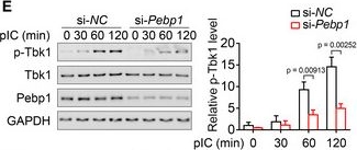 Fig.7.E showing Western Blotting in a Mus musculus (House mouse) sample from the publication: AAV induces hepatic necroptosis and carcinoma in diabetic and obese mice dependent on Pebp1 pathway.