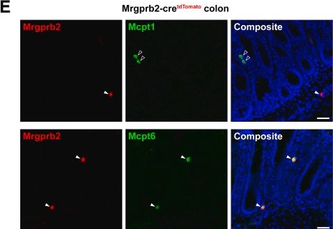 Fig.1.E showing Immunohistochemistry-immunofluorescence in a Mus musculus (House mouse) sample from the publication: Mrgprb2-dependent Mast Cell Activation Plays a Crucial Role in Acute Colitis.