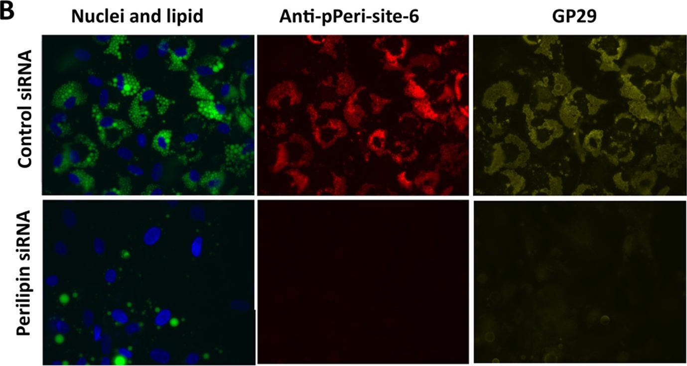 Differential phosphorylation of perilipin 1A at the initiation of lipolysis revealed by novel monoclonal antibodies and high content analysis.