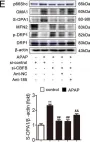 Fig.7.E showing Western Blotting from the publication: circ-CBFB upregulates p66Shc to perturb mitochondrial dynamics in APAP-induced liver injury.