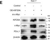 Fig.5.E showing Western Blotting from the publication: Targeting KIF20A blocks lactylation modification to suppress immune escape in hepatocellular carcinoma.