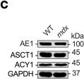 Fig.1.C showing Western Blotting in a Mus musculus (House mouse) sample from the publication: Impaired hydrogen sulfide biosynthesis underlies eccentric contraction-induced force loss in dystrophin-deficient skeletal muscle.