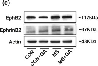 Fig.2.C showing Western Blotting from the publication: Gallic acid alleviates visceral hyperalgesia following maternal separation in mice by inhibiting EphrinB2/EphB2 signaling mediated activation of neurons and glial cells.