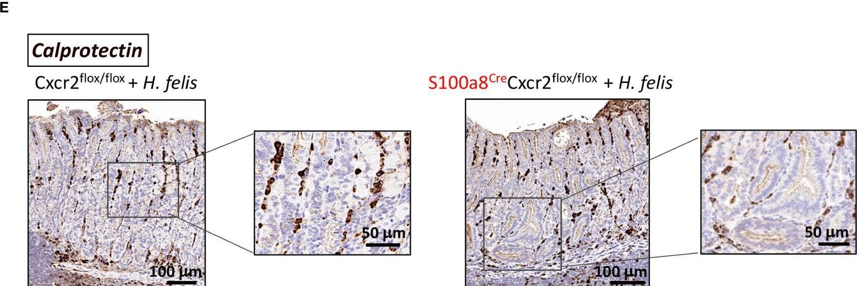 Fig.6.E showing Immunohistochemistry in a Mus musculus (House mouse) sample from the publication: The Cxcr2+ subset of the S100a8+ gastric granylocytic myeloid-derived suppressor cell population (G-MDSC) regulates gastric pathology.