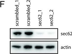 Fig.5.F showing Western Blotting in a Homo sapiens (Human) sample from the publication: A virus-packageable CRISPR screen identifies host factors mediating interferon inhibition of HIV.