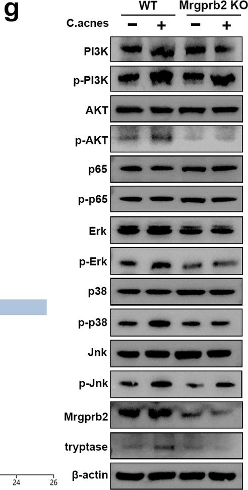 Fig.6.G showing Western Blotting in a Mus musculus (House mouse) sample from the publication: Mrgprb2-mediated mast cell activation exacerbates Modic changes by regulating immune niches.