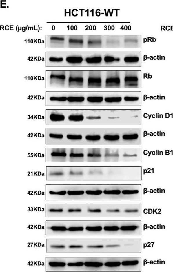 Fig.3.E showing Western Blotting in a Homo sapiens (Human) sample from the publication: Rhus coriaria (Sumac) induces autophagic cell death and inhibits mTOR, p38MAPK and STAT3 pathways in 5fluorouracil-resistant colorectal cancer cells.