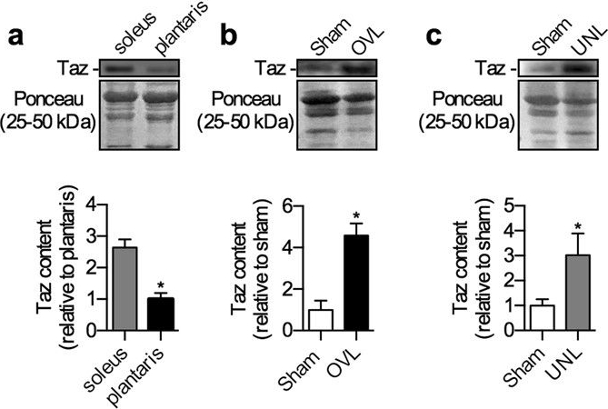 Fig.5.A,B,C showing Western Blotting in a Mus musculus (House mouse) sample from the publication: Cardiolipin content, linoleic acid composition, and tafazzin expression in response to skeletal muscle overload and unload stimuli.