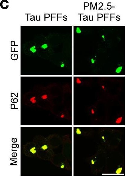 Fig.2.C showing Immunocytochemistry-immunofluorescence in a Mus musculus (House mouse) sample from the publication: PM2.5 triggers tau aggregation in a mouse model of tauopathy.