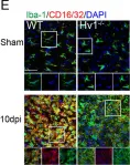 Fig.2.E showing Immunohistochemistry in a Mus musculus (House mouse) sample from the publication: Deficiency of microglial Hv1 channel is associated with activation of autophagic pathway and ROS production in LPC-induced demyelination mouse model.