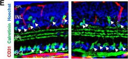 Fig.4.E showing Immunohistochemistry in a Mus musculus (House mouse) sample from the publication: In Utero Alcohol Exposure Impairs Retinal Angiogenesis and the Microvessel-Associated Positioning of Calretinin Interneurons.