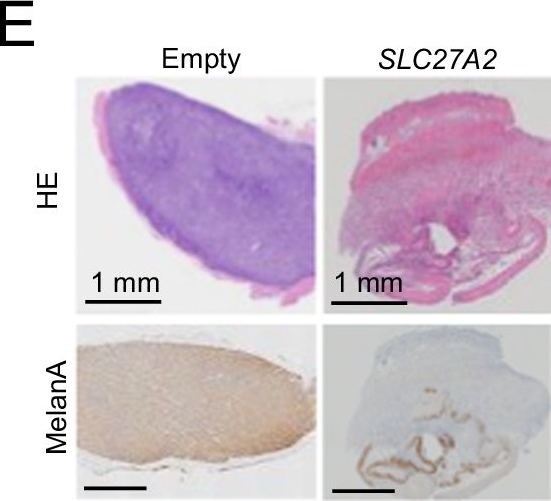 Fig.5.E showing Immunohistochemistry in a Homo sapiens (Human) sample from the publication: Unique lipid composition maintained by extracellular blockade leads to prooncogenicity.