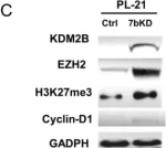 Fig.3.C showing Western Blotting in a Homo sapiens (Human) sample from the publication: The KDM2B- let-7b -EZH2 axis in myelodysplastic syndromes as a target for combined epigenetic therapy.