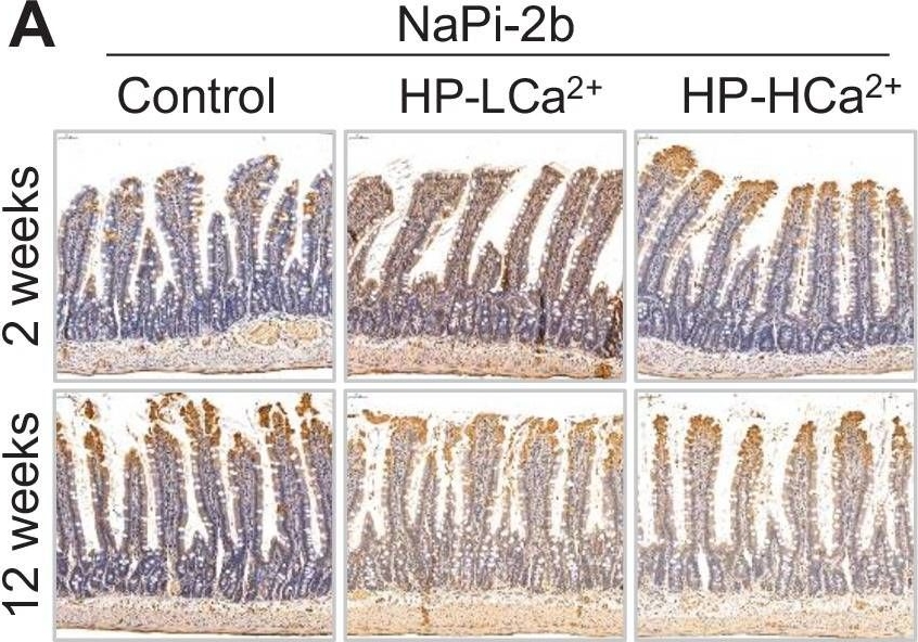 Fig.5.A showing Immunohistochemistry in a Rattus norvegicus (Rat) sample from the publication: High-phytate/low-calcium diet is a risk factor for crystal nephropathies, renal phosphate wasting, and bone loss.