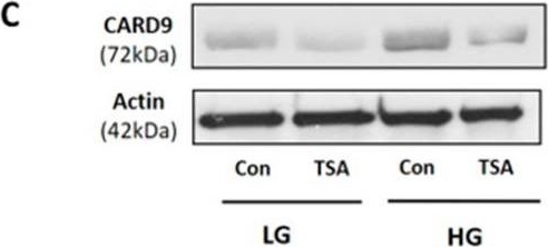 Fig.1.C showing Western Blotting in a Rattus norvegicus (Rat) sample from the publication: Regulatory Roles of Histone Deacetylation in Metabolic Stress-Induced Expression of Caspase Recruitment Domain-Containing Protein 9 (CARD9) in Pancreatic β-Cells.