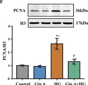 Fig.1.F showing Western Blotting in a Rattus norvegicus (Rat) sample from the publication: Gingerenone A attenuates diabetic vascular remodeling through AMPK/mTOR/S6K1 signaling.