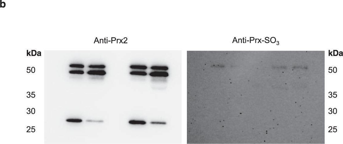 Fig.6.B showing Western Blotting from the publication: Hydrogen peroxide signaling via its transformation to a stereospecific alkyl hydroperoxide that escapes reductive inactivation.