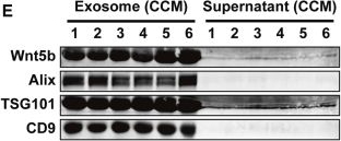 Fig.6.E showing Western Blotting from the publication: Wnt5b/FZD1/LRP6 signaling drives renal fibrosis by triggering cytoplasmic stabilization and nuclear translocation of β-catenin under hypoxia.
