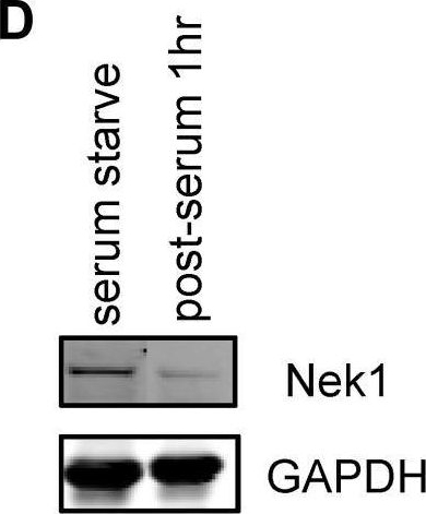 Fig.5.D showing Western Blotting from the publication: The master cell cycle regulator APC-Cdc20 regulates ciliary length and disassembly of the primary cilium.