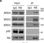 Fig.2.A showing Western Blotting from the publication: Retinoblastoma protein as an intrinsic BRD4 inhibitor modulates small molecule BET inhibitor sensitivity in cancer.