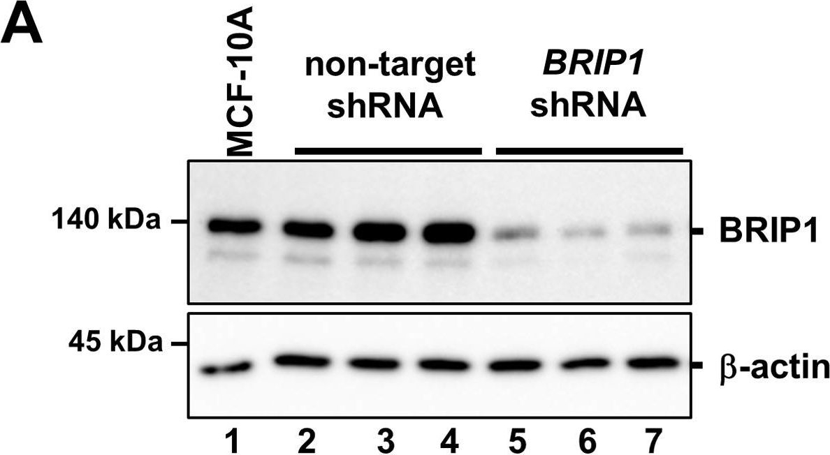 Fig.1.A showing Western Blotting in a Homo sapiens (Human) sample from the publication: Loss of the BRCA1-interacting helicase BRIP1 results in abnormal mammary acinar morphogenesis.