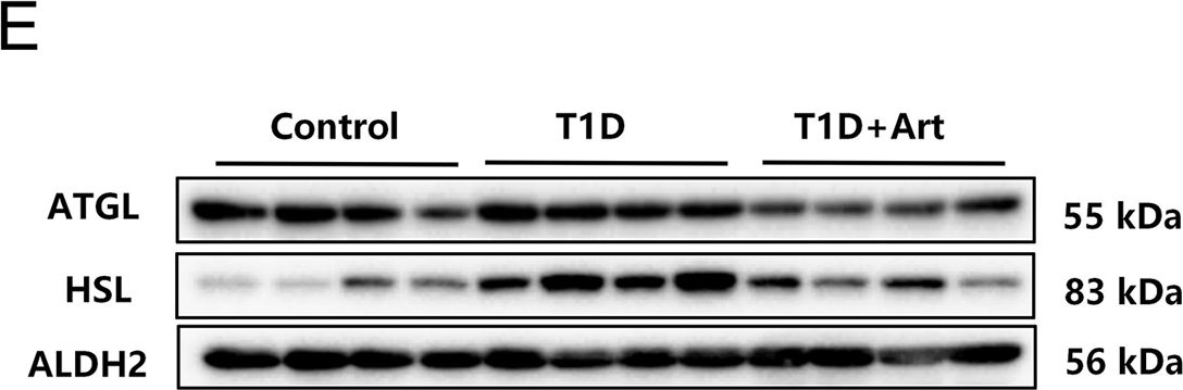 Fig.5.E showing Western Blotting in a Mus musculus (House mouse) sample from the publication: Artemether ameliorates type 1 diabetic liver injury alongside the associated defects in mitochondrial ultrastructure and central carbon metabolism.