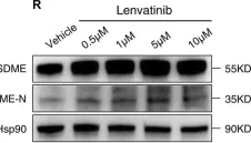 Fig.11.R showing Western Blotting from the publication: Identification and Validation of Pyroptosis-Related Gene Signature to Predict Prognosis and Reveal Immune Infiltration in Hepatocellular Carcinoma.