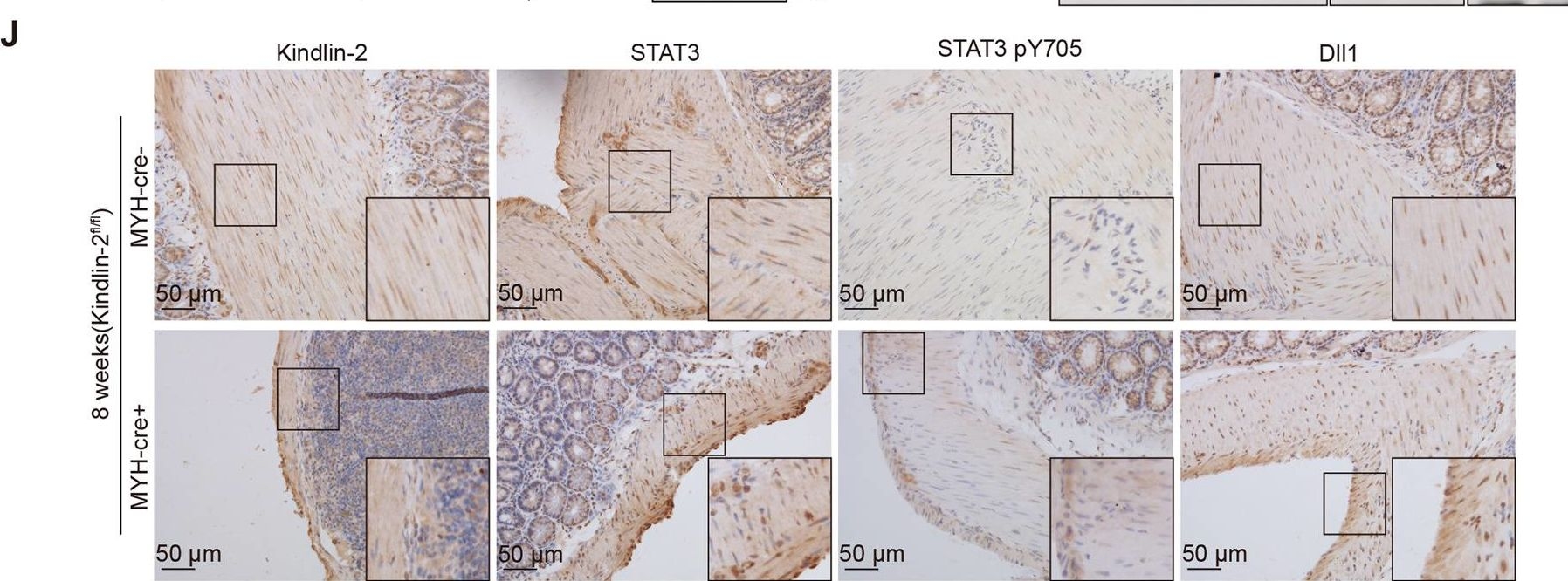 Fig.5.J showing Immunohistochemistry in a Mus musculus (House mouse) sample from the publication: Kindlin-2 in myoepithelium controls luminal progenitor commitment to alveoli in mouse mammary gland.