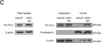 Fig.1.C showing Western Blotting from the publication: Inhibition of Phosphatidylcholine-Specific Phospholipase C Interferes with Proliferation and Survival of Tumor Initiating Cells in Squamous Cell Carcinoma.