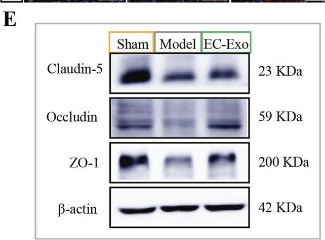 Fig.4.E showing Western Blotting in a Mus musculus (House mouse) sample from the publication: Protective effect of brain microvascular endothelial cell-derived exosomes on blood-brain barrier induced by ischemia-reperfusion injury in vivo and in vitro.