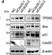 Fig.5.D showing Western Blotting in a Homo sapiens (Human) sample from the publication: The Tumor Suppressor TPD52-Governed Endoplasmic Reticulum Stress is Modulated by APCCdc20.