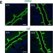 Fig.2.E showing Immunohistochemistry-immunofluorescence in a Mus musculus (House mouse) sample from the publication: Defects in microvillus crosslinking sensitize to colitis and inflammatory bowel disease.