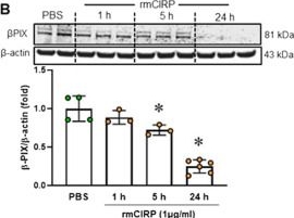 Fig.5.B showing Western Blotting from the publication: Extracellular CIRP dysregulates macrophage bacterial phagocytosis in sepsis.