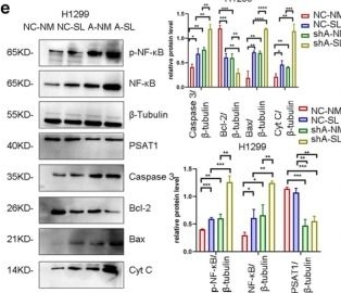 Fig.5.E showing Western Blotting in a Homo sapiens (Human) sample from the publication: PSAT1 Promotes NSCLC Progression via the De Novo Serine Synthesis Pathway and Represents a Therapeutic Vulnerability.