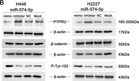 Fig.6.B showing Western Blotting in a Homo sapiens (Human) sample from the publication: Tumor invasion and metastasis regulated by microRNA-184 and microRNA-574-5p in small-cell lung cancer.