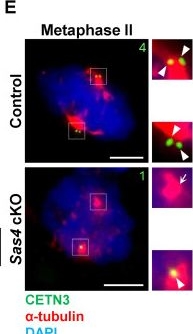 Fig.3.E showing Immunocytochemistry-immunofluorescence in a Mus musculus (House mouse) sample from the publication: Meiotic divisions and round spermatid formation do not require centriole duplication in mice.